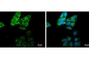 ICC/IF Image MMP13 antibody [N3C1], Internal detects MMP13 protein at cytoplasm by immunofluorescent analysis. (MMP13 anticorps)