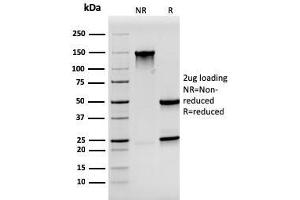 SDS-PAGE Analysis Purified Synaptophysin Mouse Monoclonal Antibody (SYP/3551). (MSH2 anticorps  (AA 224-313))