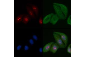 ABIN6263193 and ABIN6266724 staining Hela cells by IF/ICC.