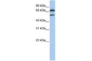 WB Suggested Anti-FBXO7 Antibody Titration:  0. (FBXO7 anticorps  (Middle Region))