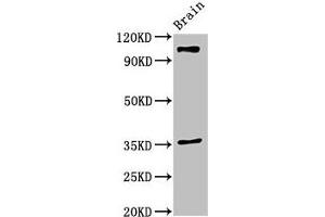 Western Blot Positive WB detected in: Mouse brain tissue All lanes: SLITRK5 antibody at 2 μg/mL Secondary Goat polyclonal to rabbit IgG at 1/50000 dilution Predicted band size: 108, 80 kDa Observed band size: 108 kDa (SLITRK5 anticorps  (AA 617-890))
