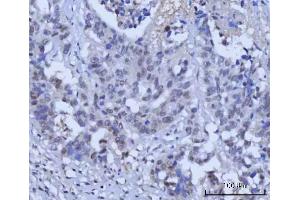 IHC analysis of RAD51C using anti-RAD51C antibody (ABIN7599718). (RAD51C anticorps  (AA 11-342))