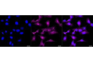 anti-Podoplanin (PDPN) antibody