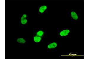 Immunofluorescence of monoclonal antibody to SOX9 on HepG2 cell.