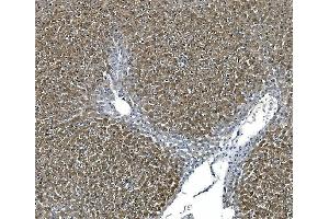 IHC analysis of ASS1 using anti-ASS1 antibody (ABIN7601191).