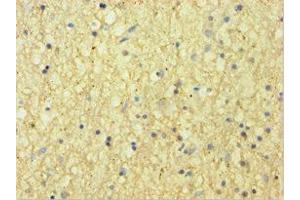 Immunohistochemistry of paraffin-embedded human brain tissue using ABIN7145442 at dilution of 1:100 (CNDP1 anticorps  (AA 1-280))