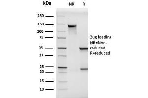 SDS-PAGE Analysis Purified MCAM Mouse Monoclonal Antibody (MCAM/3046). (MCAM anticorps  (AA 226-374))