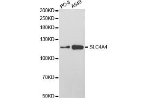Western Blotting (WB) image for anti-Solute Carrier Family 4, Sodium Bicarbonate Cotransporter, Member 4 (SLC4A4) antibody (ABIN1876520) (SLC4A4 anticorps)