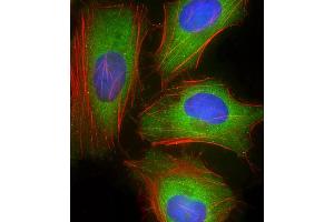 Immunofluorescent analysis of 4 % paraformaldehyde-fixed, 0.