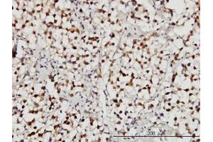 Image no. 3 for anti-Ubiquitin Specific Peptidase 34 (USP34) (AA 3296-3396) antibody (ABIN599094) (USP34 anticorps  (AA 3296-3396))