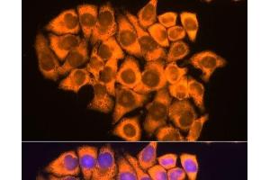 Immunofluorescence analysis of HeLa cells using RPL17 Polyclonal Antibody at dilution of 1:100. (RPL17 anticorps)