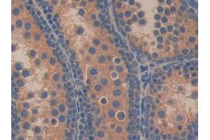 Detection of OLFM4 in Mouse Testis Tissue using Polyclonal Antibody to Olfactomedin 4 (OLFM4)