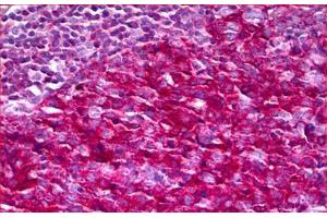 Anti-NF1 antibody IHC staining of human tonsil.