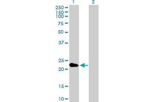 Western Blot analysis of CRYBA2 expression in transfected 293T cell line by CRYBA2 MaxPab polyclonal antibody. (CRYbA2 anticorps  (AA 1-197))