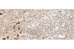 Immunohistochemistry of paraffin-embedded Human tonsil tissue using RMND5A Polyclonal Antibody at dilution of 1:50(x200)