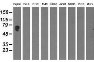 Western blot analysis of extracts (35 µg) from 9 different cell lines by using anti-AFP monoclonal antibody. (alpha Fetoprotein anticorps)
