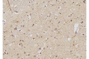 ABIN6261810 and ABIN6268934 at 1/100 staining Human brain tissue by IHC-P. (FOXP3 anticorps  (C-Term))