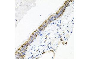 Immunohistochemistry of paraffin-embedded human lung using ACVR2A antibody at dilution of 1:100 (x40 lens). (ACVR2A anticorps)
