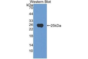 Western Blotting (WB) image for anti-Noggin (NOG) (AA 28-232) antibody (ABIN3201688) (NOG anticorps  (AA 28-232))