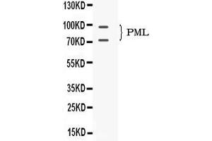 Western blot analysis of PML Protein expression in mouse testis extract ( Lane 1). (PML anticorps  (N-Term))