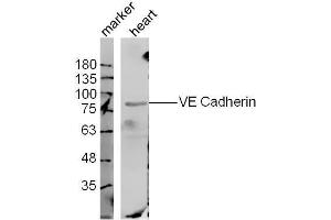 Mouse heart lysates probed with VE Cadherin Polyclonal Antibody, unconjugated  at 1:300 overnight at 4°C followed by a conjugated secondary antibody at 1:10000 for 60 minutes at 37°C. (Cadherin 5 anticorps  (AA 601-700))