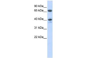 AGTR1 antibody used at 1 ug/ml to detect target protein.