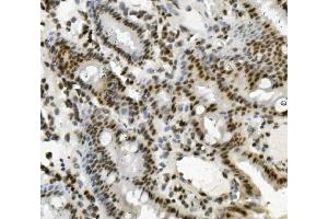 IHC analysis of PRDM5 using anti-PRDM5 antibody (ABIN7600853). (PRDM5 anticorps  (AA 24-630))