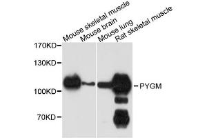 Western blot analysis of extracts of various cell lines, using PYGM antibody. (PYGM anticorps)