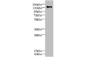 Western blot All lanes: PLXNB2 antibody IgG at 2. (Plexin B2 anticorps  (AA 1080-1200))