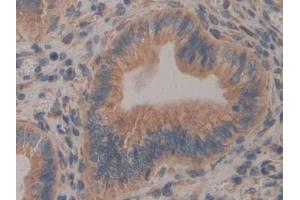 Detection of CNX in Mouse Uterus Tissue using Polyclonal Antibody to Calnexin (CNX)