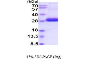 SDS-PAGE (SDS) image for UL16 Binding Protein 2 (ULBP2) (AA 26-216) protein (His tag) (ABIN5854768)