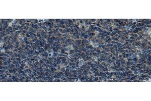 Immunohistochemistry of paraffin-embedded Human tonsil tissue using CUL5 Polyclonal Antibody at dilution of 1:55(x200)