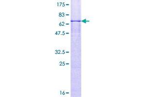 Image no. 1 for Necdin Homolog (Mouse) (NDN) (AA 1-321) protein (GST tag) (ABIN1312169)