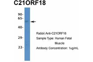 Host:  Rabbit  Target Name:  C21ORF18  Sample Type:  Human Fetal Muscle  Antibody Dilution:  1. (SETD4 anticorps  (C-Term))