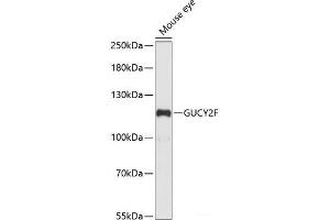 Western blot analysis of extracts of Mouse eye using GUCY2F Polyclonal Antibody at dilution of 1:1000. (GUCY2F anticorps)