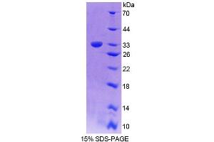 SDS-PAGE analysis of Mouse TESK1 Protein. (TSSK1 Protéine)