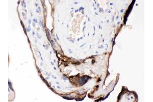 anti-CUB Domain Containing Protein 1 (CDCP1) (AA 582-667) antibody