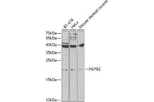 Western blot analysis of extracts of various cell lines, using HSPB2 antibody (ABIN6131082, ABIN6142054, ABIN6142055 and ABIN6219505) at 1:1000 dilution. (HSPB2 anticorps  (AA 1-182))
