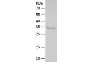 Western Blotting (WB) image for Pyridoxal (Pyridoxine, Vitamin B6) Phosphatase (PDXP) (AA 1-296) protein (His tag) (ABIN7124711)