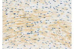ABIN6261824 and ABIN6273118 at 1/100 staining Mouse heart tissue by IHC-P.