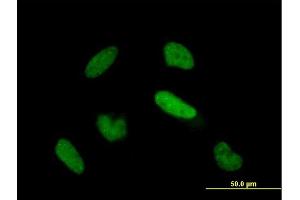 Immunofluorescence of purified MaxPab antibody to TIAL1 on HeLa cell.
