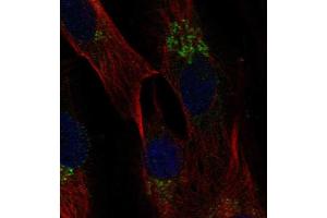Immunofluorescent staining of human cell line BJ shows localization to the Golgi apparatus. (CCL2 anticorps  (AA 25-99))