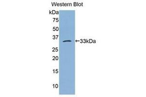 Western Blotting (WB) image for anti-Bleomycin Hydrolase (BLMH) (AA 213-447) antibody (ABIN1175598) (BLMH anticorps  (AA 213-447))