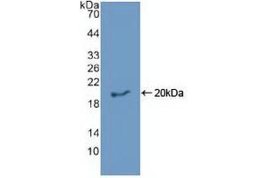 Western blot analysis of recombinant Human EREG. (Epiregulin anticorps  (AA 30-169))