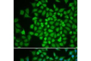 Immunofluorescence analysis of HeLa cells using COPS5 Polyclonal Antibody (COPS5 anticorps)