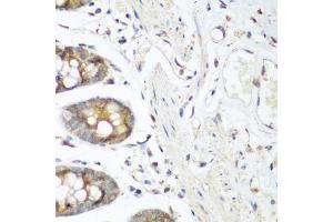 Immunohistochemistry of paraffin-embedded human colon using FLT4 antibody (ABIN5973266) at dilution of 1/200 (40x lens). (FLT4 anticorps)