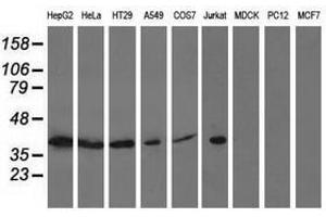 Image no. 2 for anti-Acetyl-CoA Acetyltransferase 2 (ACAT2) antibody (ABIN1496405) (ACAT2 anticorps)