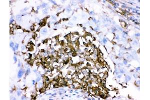 IHC analysis of CD18/ITGB2 using anti-CD18/ITGB2 antibody (ABIN3043260). (Integrin beta 2 anticorps  (AA 404-769))