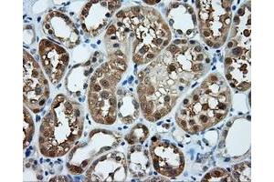 Immunohistochemical staining of paraffin-embedded prostate tissue using anti-TPMT mouse monoclonal antibody. (TPMT anticorps)