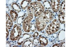 Immunohistochemical staining of paraffin-embedded prostate tissue using anti-TPMT mouse monoclonal antibody.